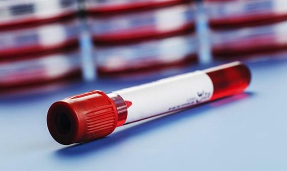 The Blood Test – John Walters